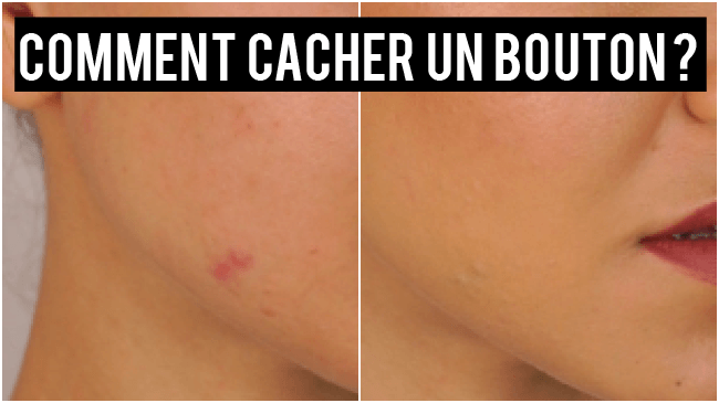 comment faire disparaitre un bouton