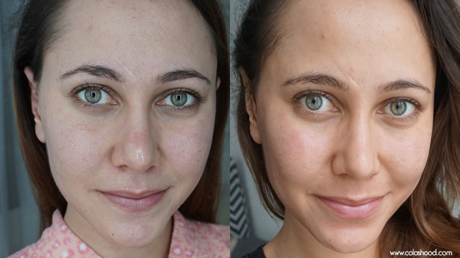 appareil anti rides visage comparatif